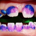Odontología de mínima intervención